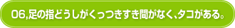 06,足の指どうしがくっつきすき間がなく、タコがある。